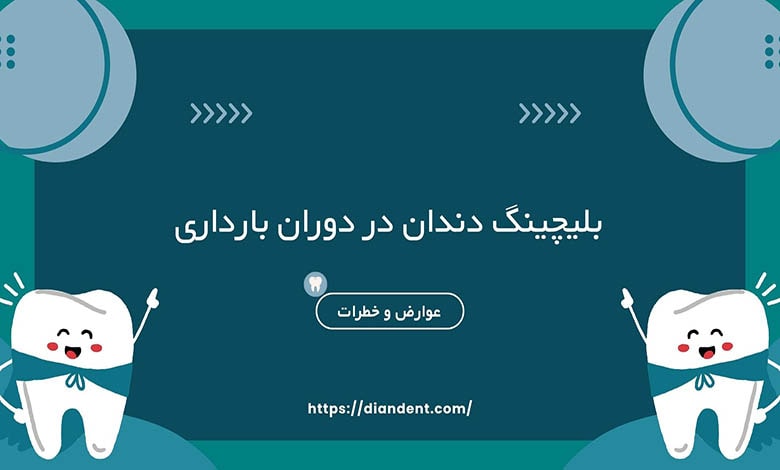 بررسی خطرات و عوارض بلیچینگ دندان در بارداری