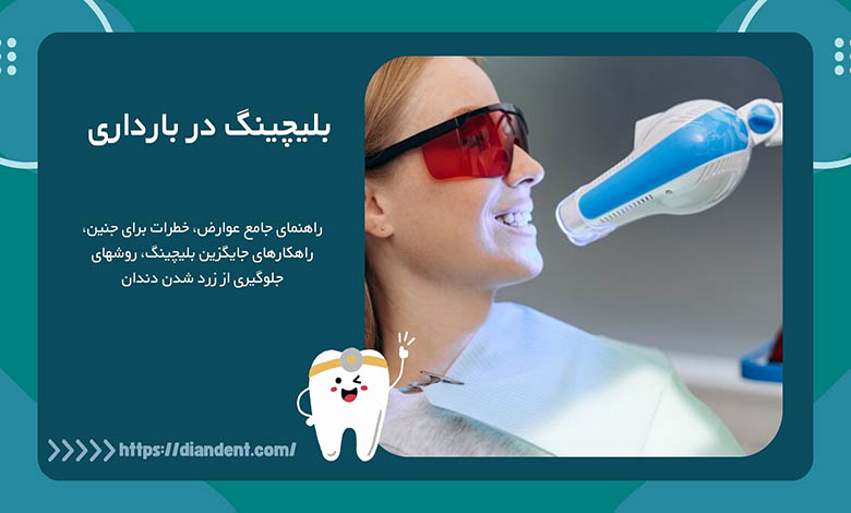 راهنمای بلیچینگ دندان در بارداری