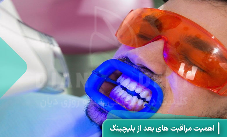 مراقبت بعد از بلیچینگ دندان چه اهمیتی دارد؟
