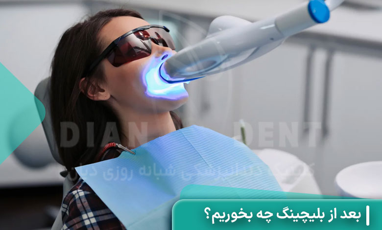 بعد از بلیچینگ چه بخوریم؟