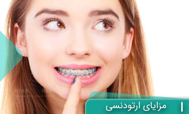 مزایای ارتودنسی دندان