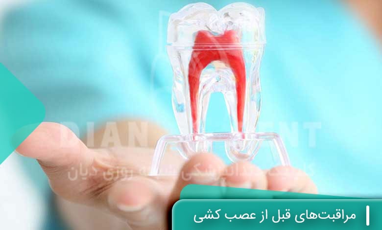 مراقبتهای قبل از عصب کشی