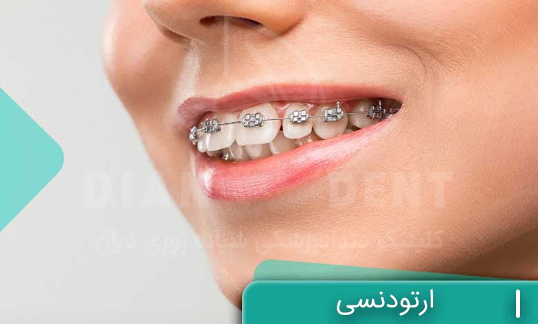 ارتودنسی دندان