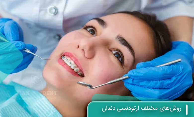 روش‌های مختلف ارتودنسی دندان