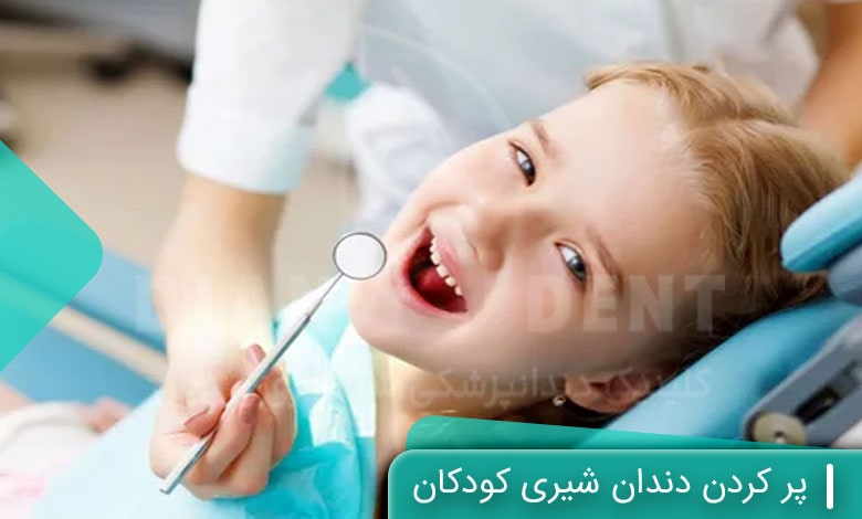 پر کردن دندان شیری کودکان