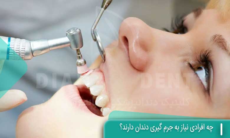 چه افرادی نیاز به جرم گیری دندان دارند؟