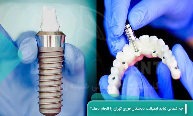 افرادی که نباید ایمپلنت دیجیتال فوری انجام دهند.