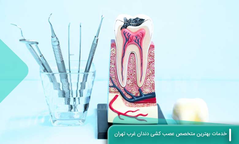 خدمات بهترین متخصص عصب کشی دندان در غرب تهران