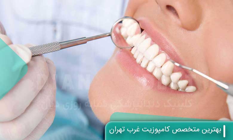 بهترین متخصص کامپوزیت غرب تهران