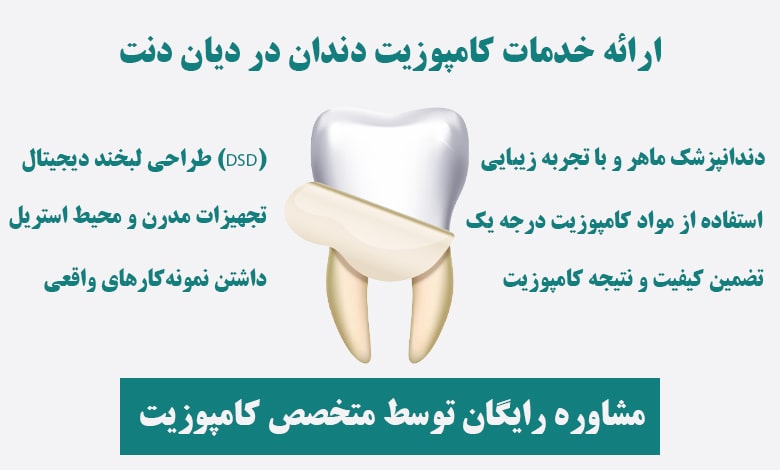 کلینیک دیان بهترین متخصص کامپوزیت غرب تهران
