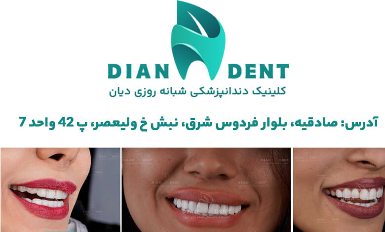 معرفی بهترین کلینیک دندانپزشکی غرب تهران: دیان