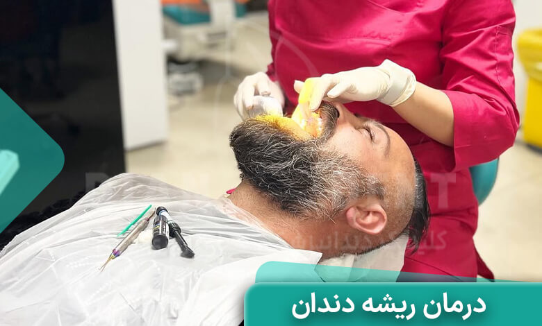 درمان تخصصی ریشه دندان در دیان دنت