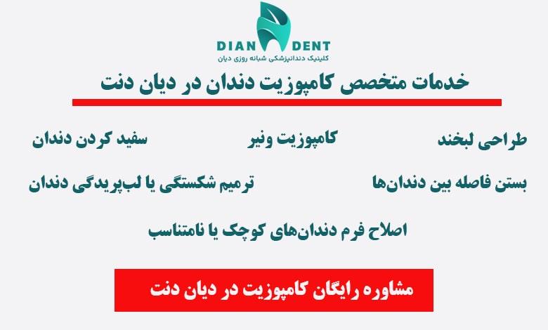 خدمات بهترین متخصص کامپوزیت دندان غرب تهران