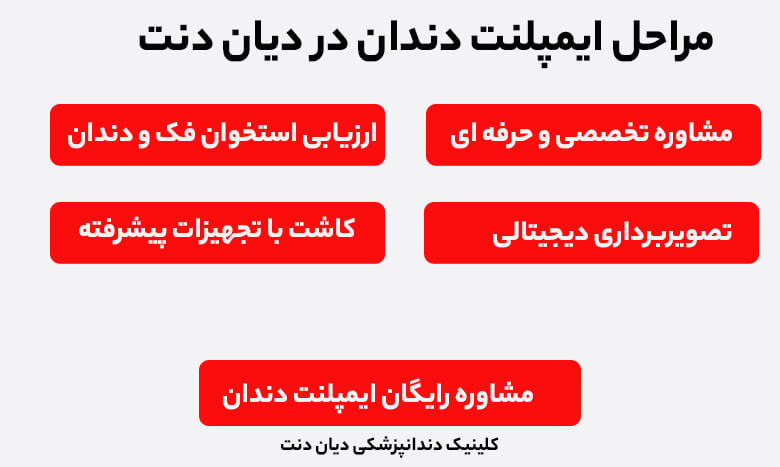 مراحل کاشت دندان در بهترین مرکز ایمپلنت غرب تهران دیان دنت