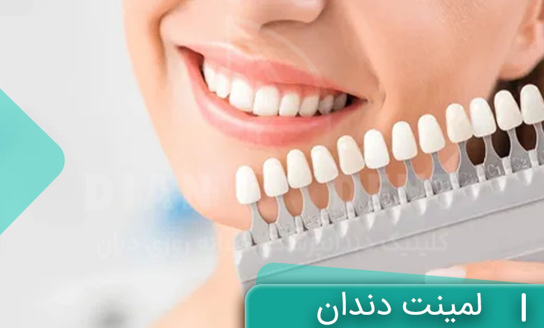 لمینت دندان