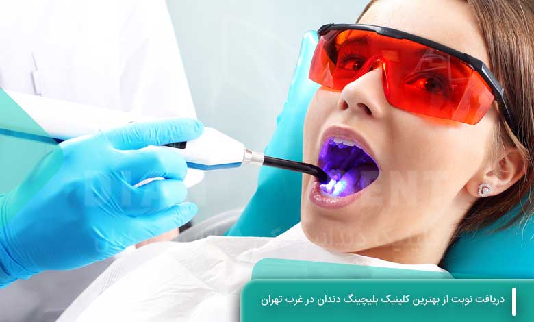 دریافت نوبت از بهترین کلینیک بلیچینگ دندان در غرب تهران