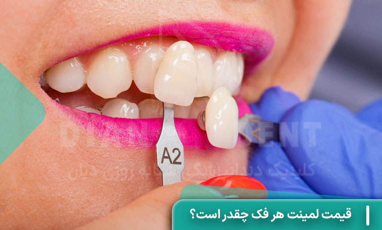 قیمت لمینت هر فک چقدر است