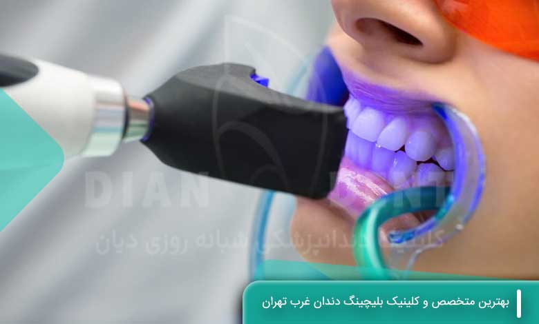 بهترین متخصص و کلینیک بلیچینگ دندان غرب تهران