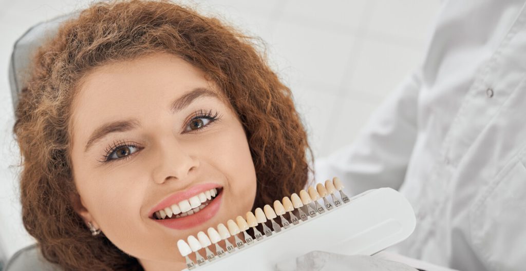 لمینت دندان چیست