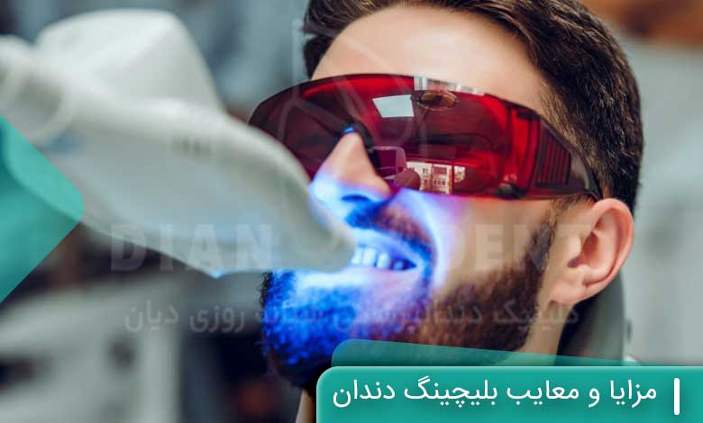 مزایا و معایب بلیچینگ دندان