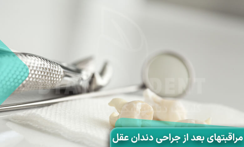مراقبت های بعد از کشیدن دندان عقل