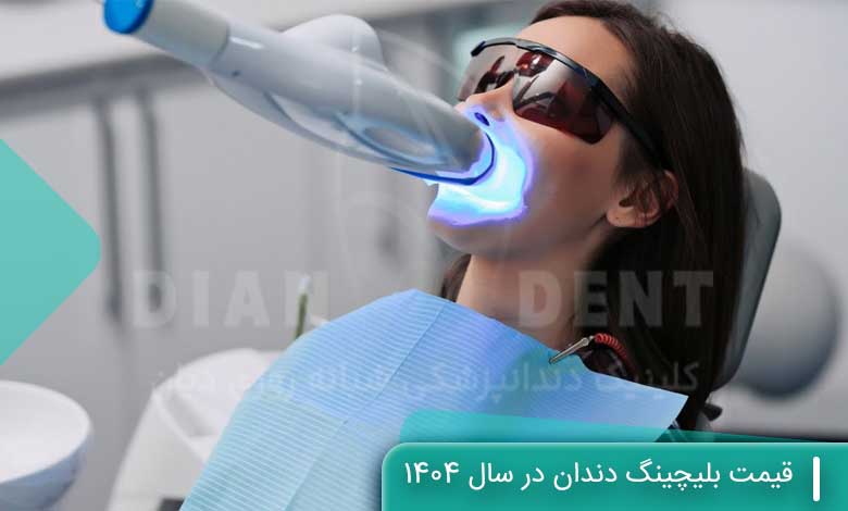 هزینه و قیمت بلیچینگ دندان در سال 1404