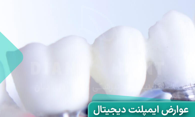 عوارض ایمپلنت دیجیتال