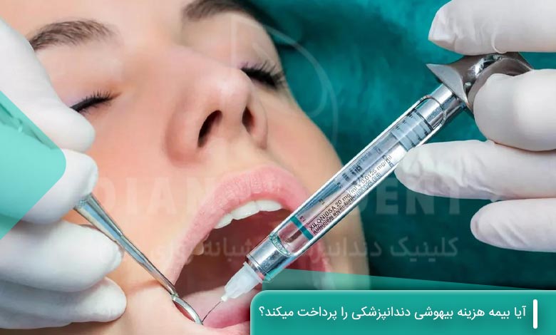آیا بیمه هزینه بیهوشی دندانپزشکی را پرداخت میکند؟