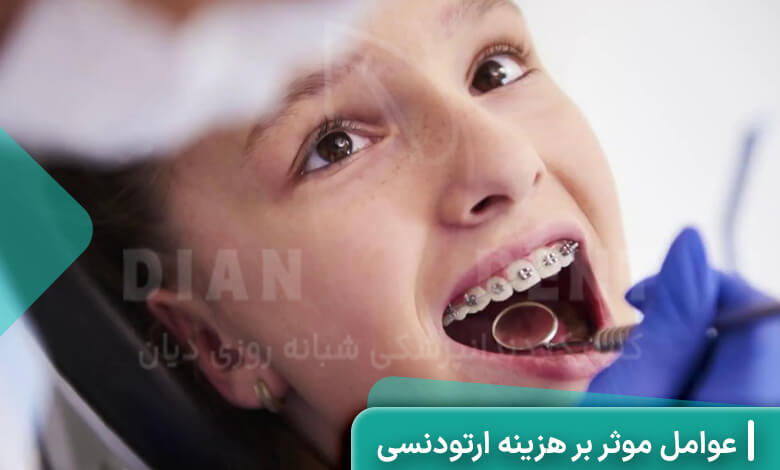عوامل موثر بر هزینه ارتودنسی