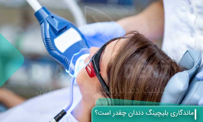 ماندگاری بلیچینگ دندان چقدر است؟