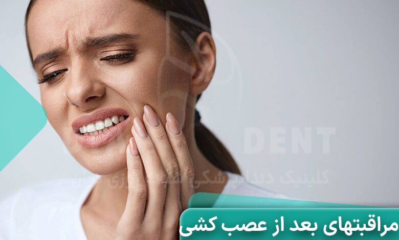 مراقبت های بعد از عصب کشی دندان