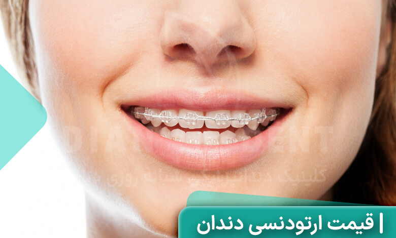 هزینه ارتودنسی دندان