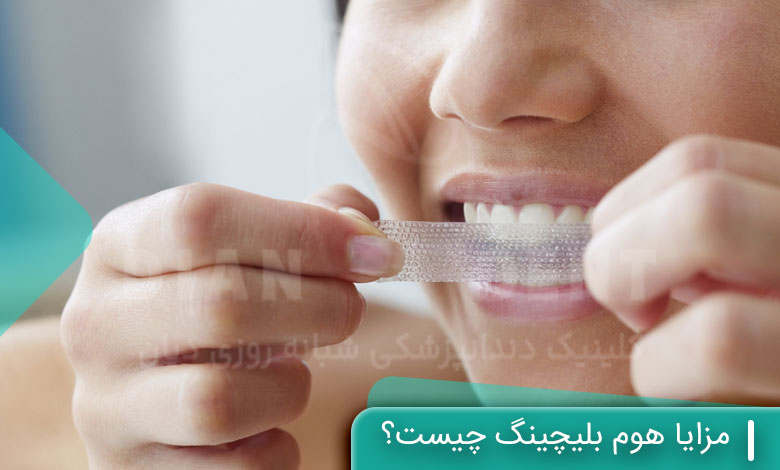 مزایا هوم بلیچینگ چیست؟