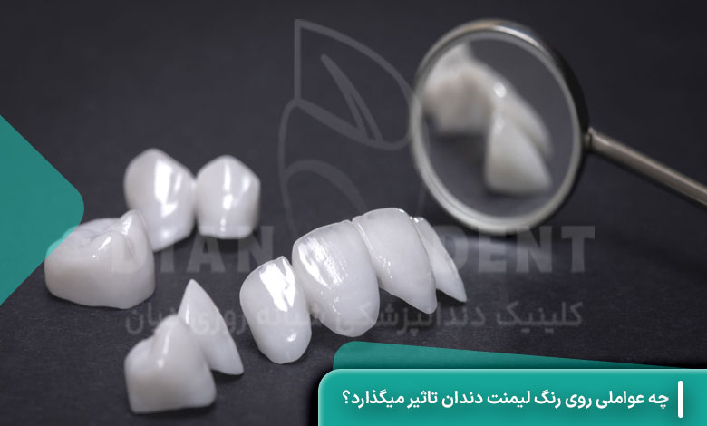 چه عواملی روی رنگ لمینت دندان تاثیر میگذارد؟