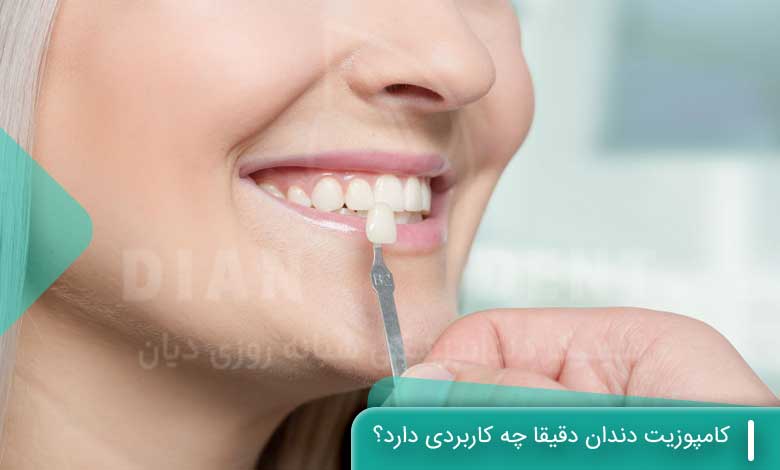 کامپوزیت دندان دقیقا چه کاربردی دارد؟