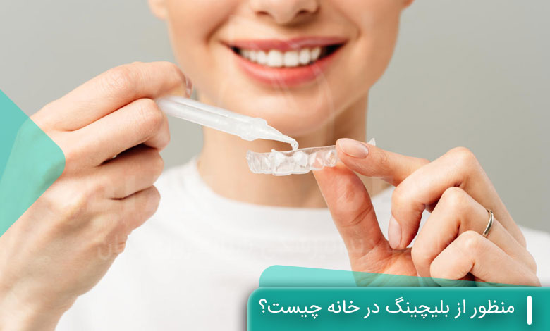 منظور از بلیچینگ در خانه چیست؟