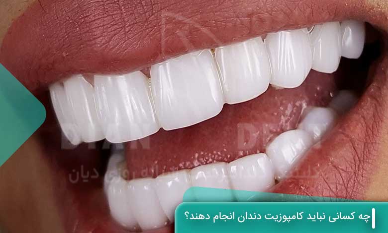 چه کسانی نباید کامپوزیت دندان انجام دهند؟