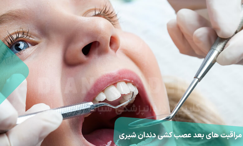 مراقبت های بعد از عصب کشی دندان شیری
