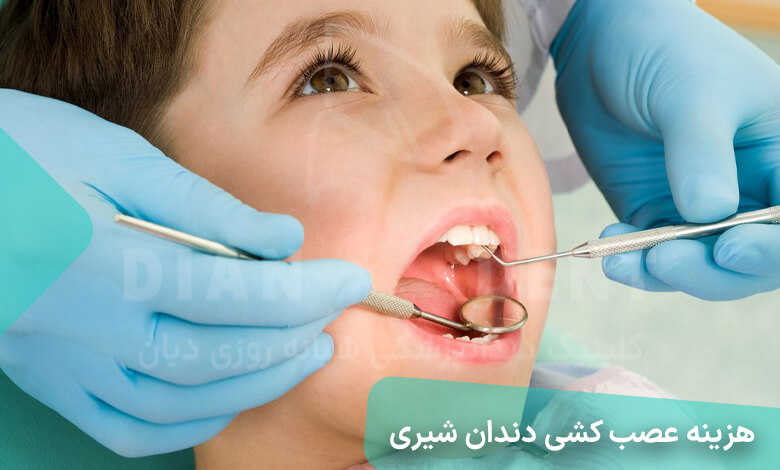 هزینه عصب کشی دندان شیری