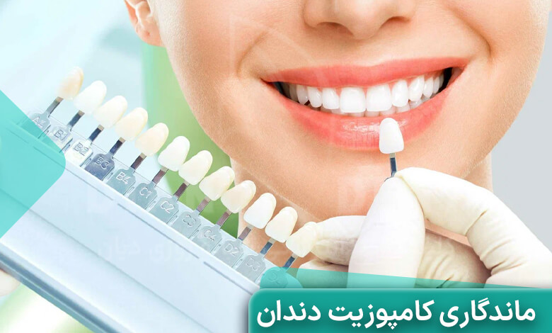 طول عمر کامپوزیت دندان
