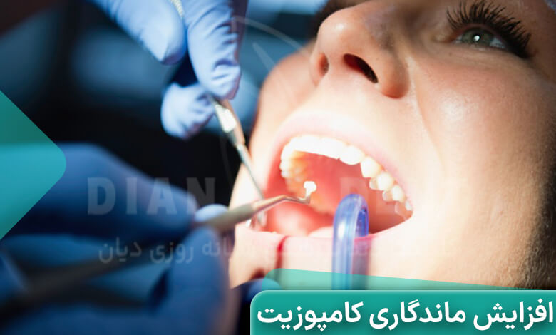افزایش طول عمر کامپوزیت دندان