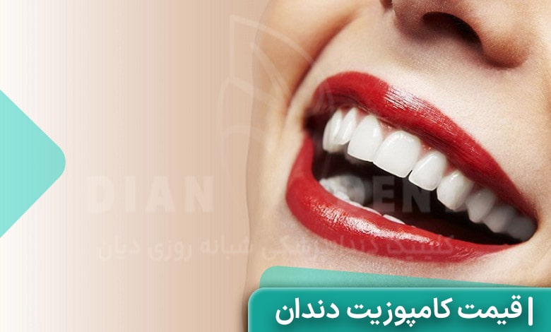 هزینه و قیمت کامپوزیت دندان