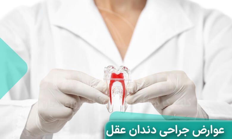 عوارض جراحی دندان عقل