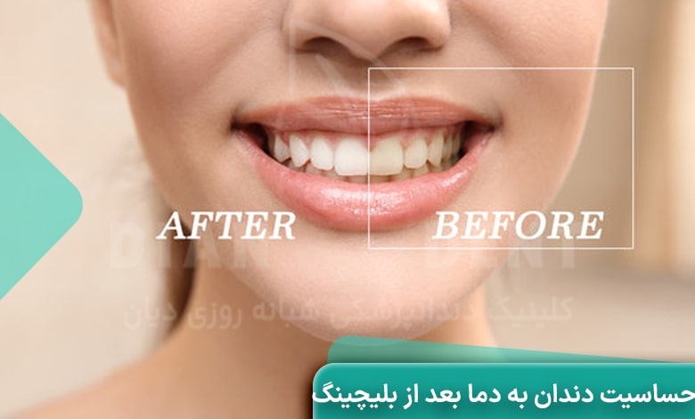 چگونه حساسیت دندان به دما بعد از بلیچینگ را درمان کنیم؟