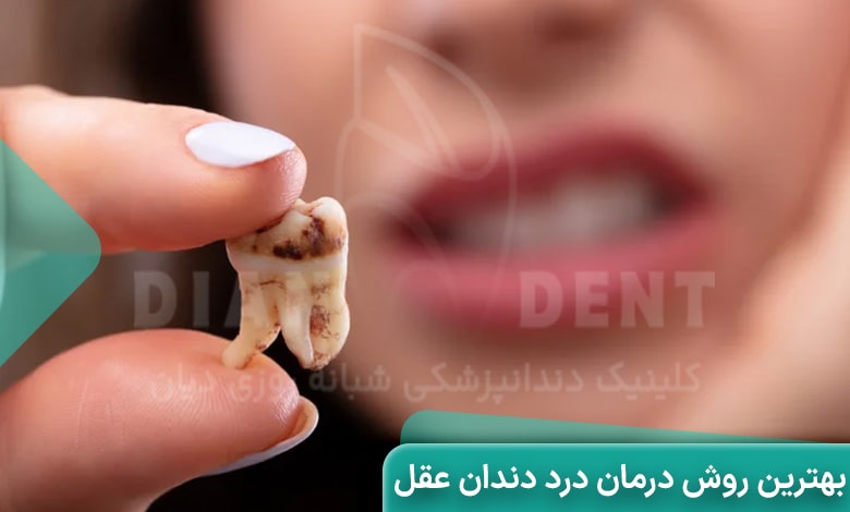 بهترین روش درمان درد دندان عقل