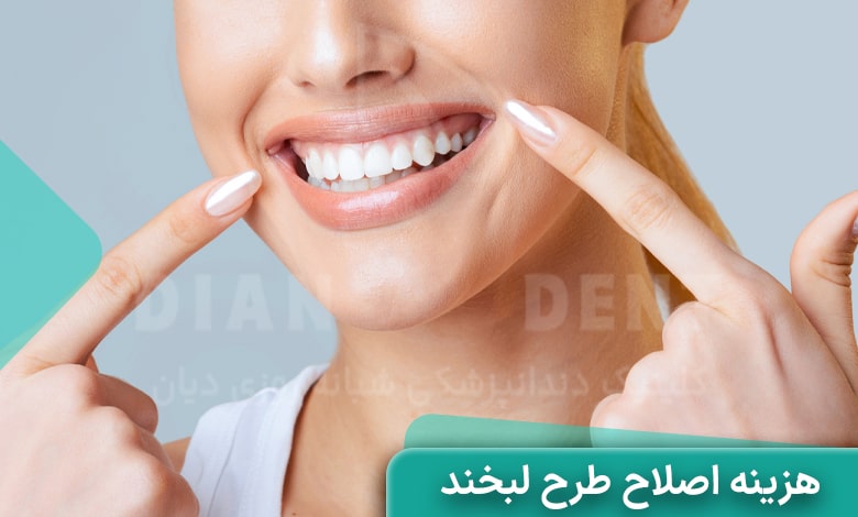هزینه اصلاح طرح لبخند چقدر است؟