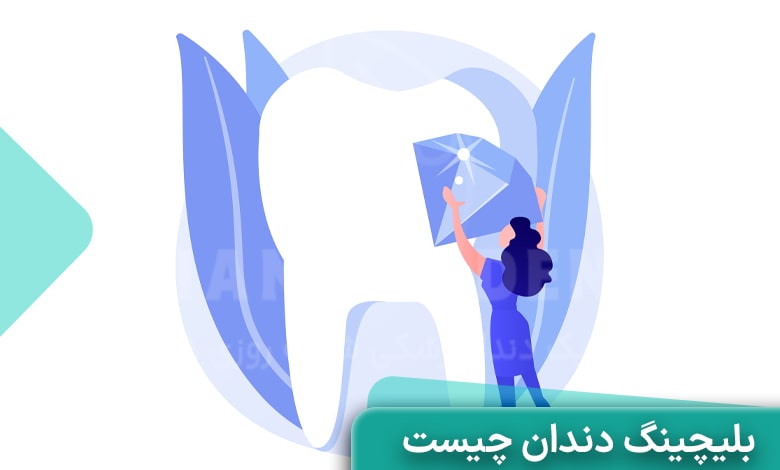 بلیچینگ دندان چیست؟