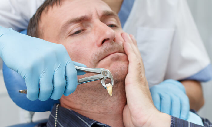 خدمات کشیدن و جراحی دندان عقل