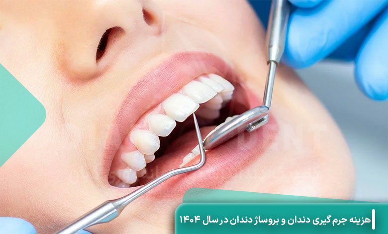 هزینه جرم گیری دندان و بروساژ دندان در سال 1404