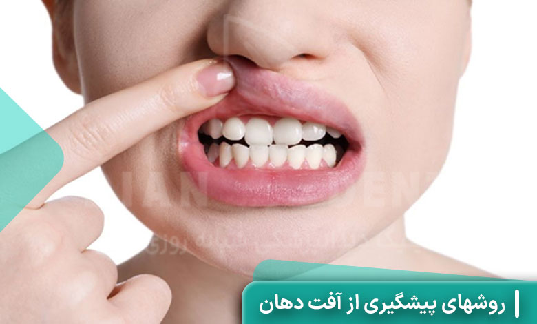 روشهای پیشگیری از آفت دهان